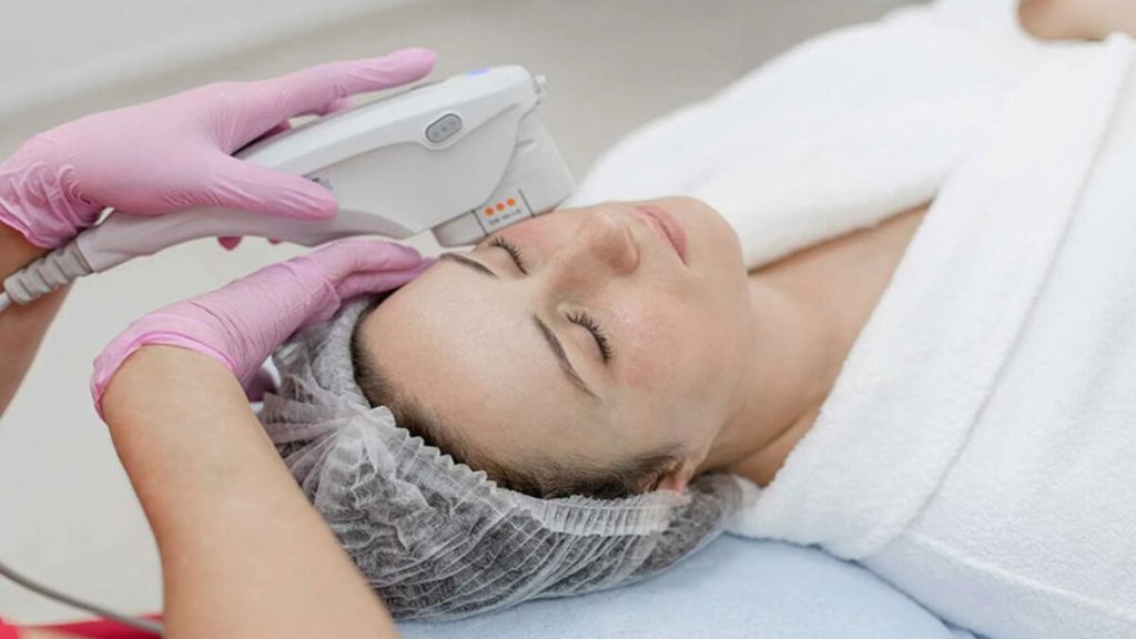 خانمی در حال انجام هایفوتراپی صورت خانمی در حال انجام هایفوتراپی صورت