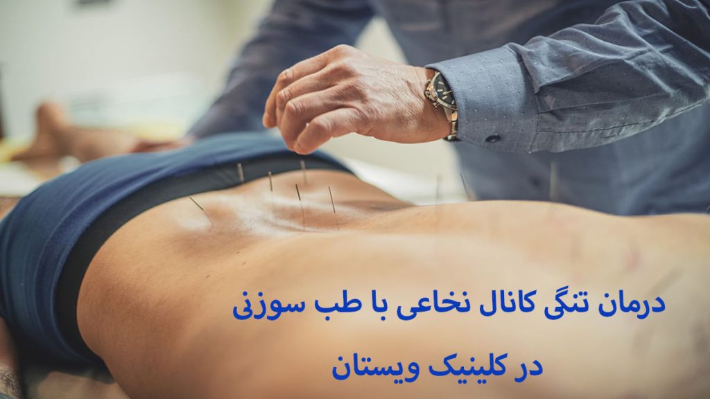 درمان تنگی کانال نخاعی یک پزشک در حال انجام طب سوزنی و یک نوشته با عنوان دررمان تنگی کانال نخاعی با طب سوزنی نشان داده می شود