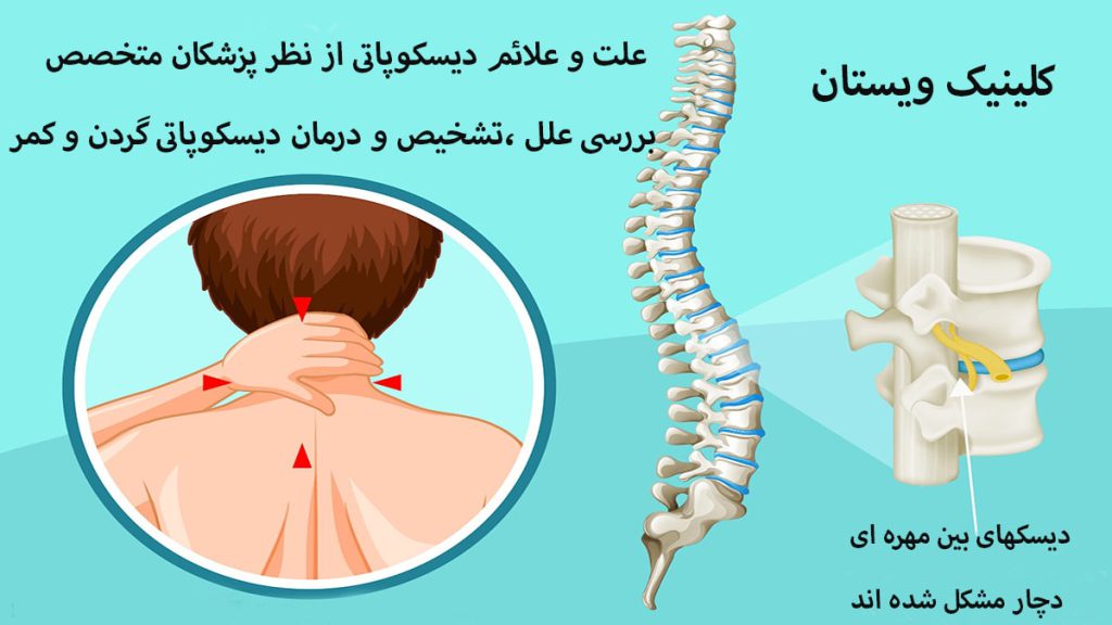 خانمی در سمت چپ دارای درد گردن و سمت راست دیسک های ستون فقرات نمایش داده می شود