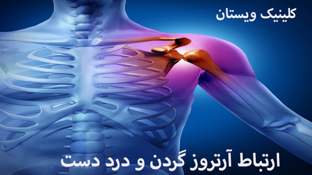 آرتروز و درد دست چپ درد در ناحیه گردن و دست فرد نشان داده می شود