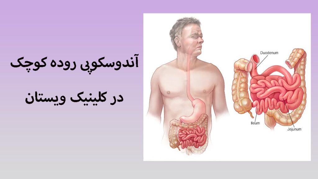 آندوسکوپی روده کوچک یک شخص در سمت چپ و یک تصویر از روده بزرگ و کوچک در سمت راست