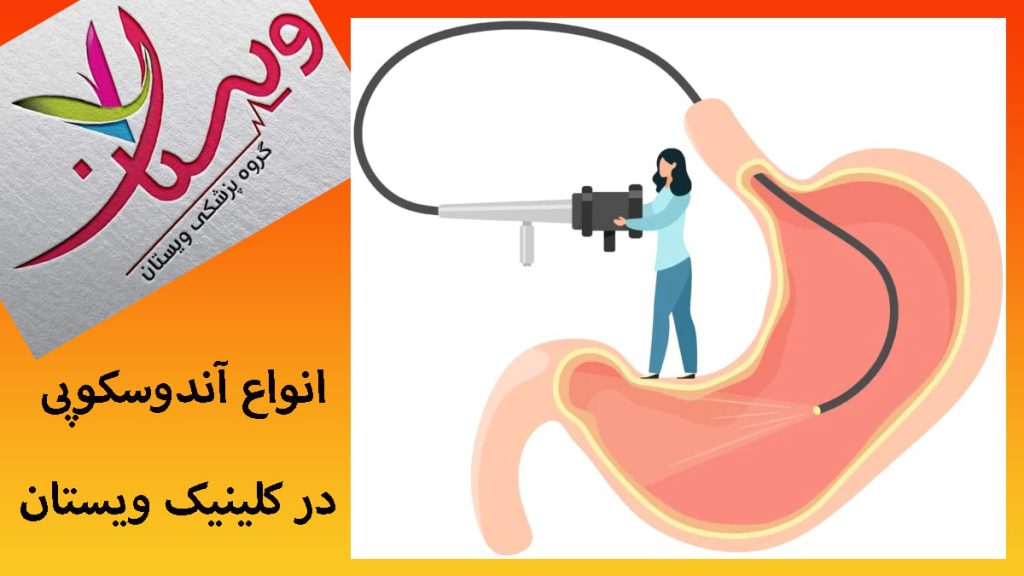 یک ختنم که بصورت انیمیشنی رو معده قرار کرفته و یک دستگاه که آندوسکوپی معده انجام می دهد