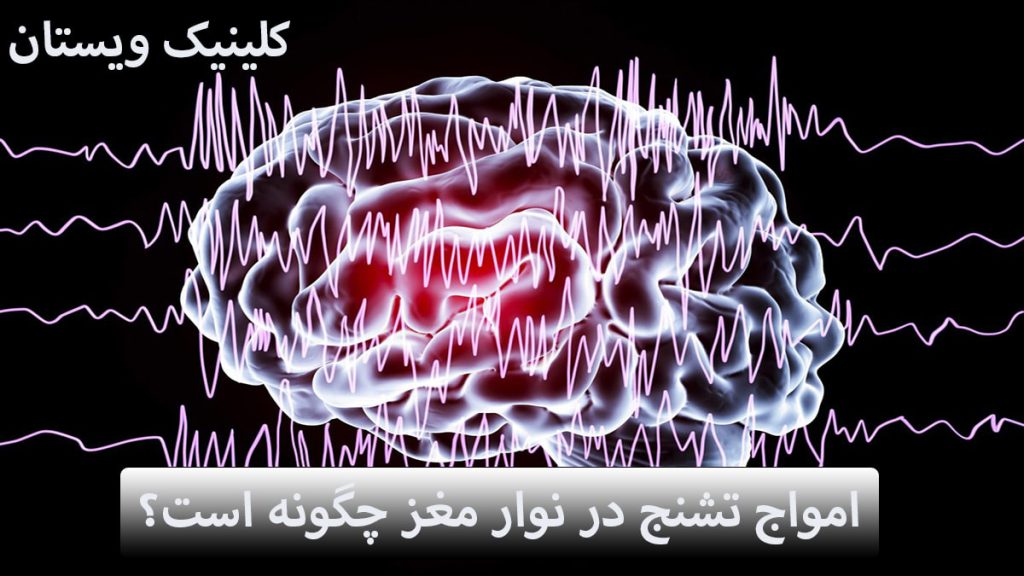 تشنج در نوار مغز یک مغز و امواج نوار مغز