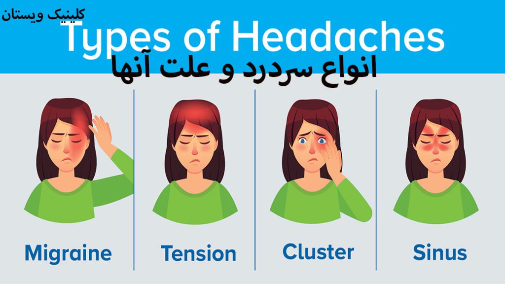 سردردهای رایج یک شخص که انواع سردردها را نشان داده است