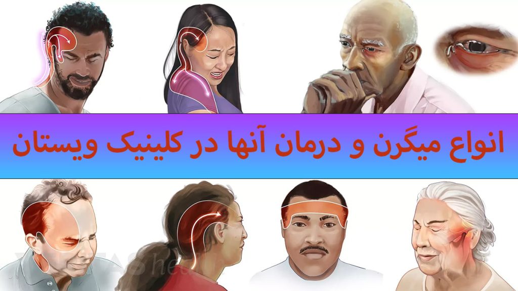 انواع میگرن چند شخص که دارای میگرن های مختلف هستند