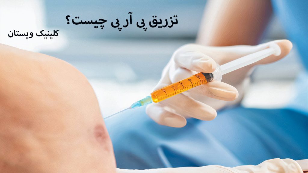 تزریق PRP پزشک در حال تزریق prp به زانوی شخص