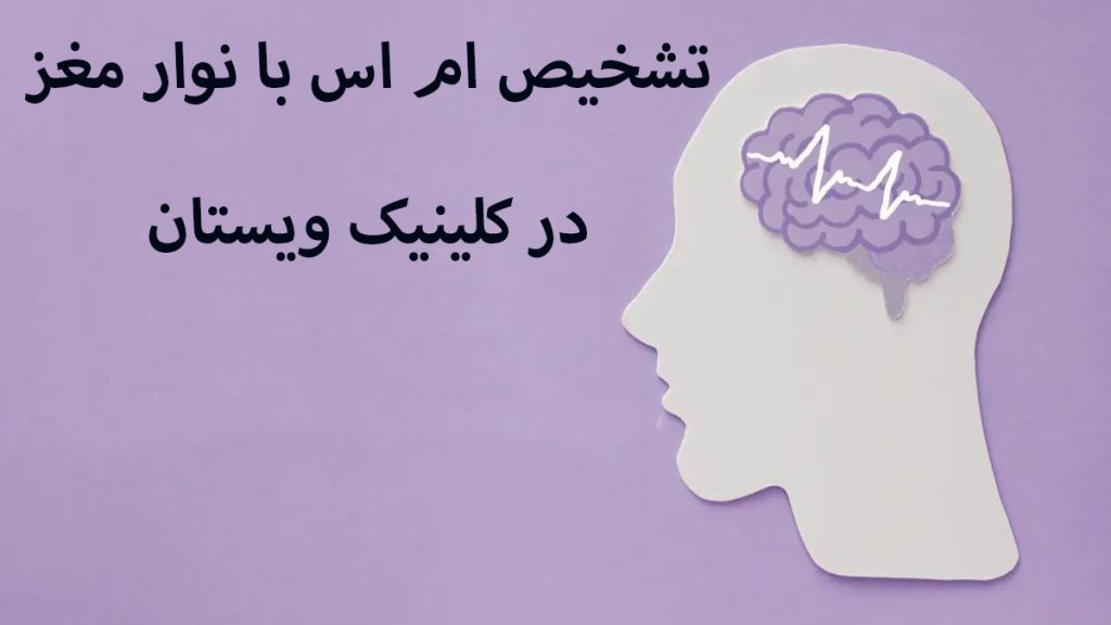 تشخیص ام اس یک شخص در سمت راست که مغز او به صورت نشان دار مشخص شده است