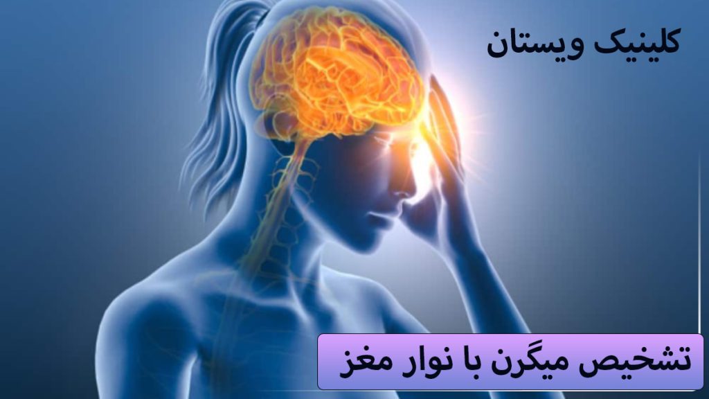 تشخیص میگرن یک شخص که دارای میگرن است و درد سر او با رنگ دیگری مشخص شده است