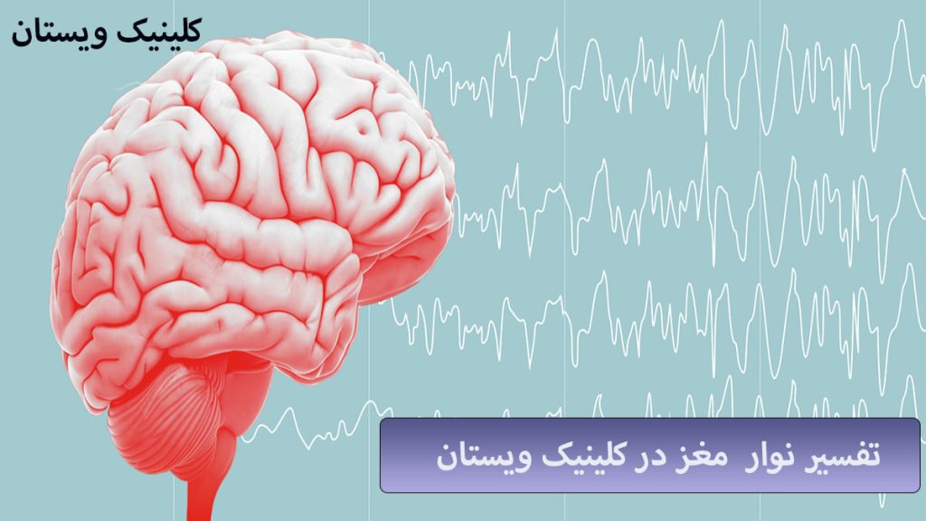 تفسیر نوار مغز امواج نوار مغز و یک مغز در سمت چپ نشان داده می شود