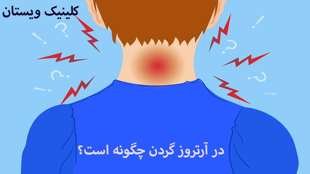 درد آرتروز گردن درد هشدار دهنده اطراف گردن
