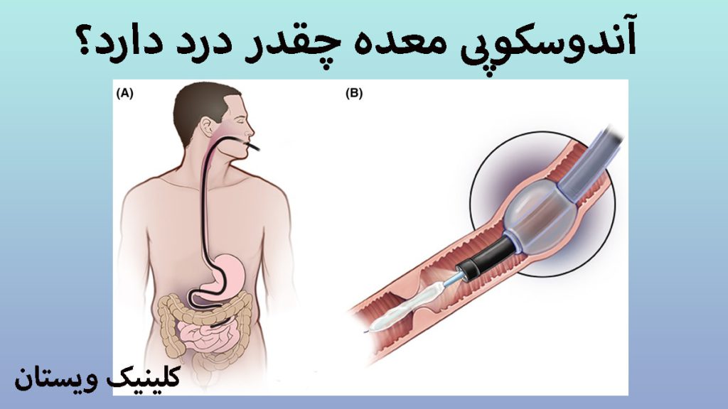 درد آندوسکوپی معده دستگاه آندوسکوپی داخل معده یک شخص