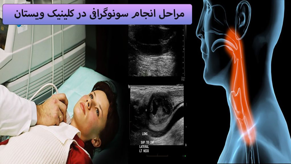مراحل انجام سونوگرافی در سمت چپ یک شخص بر وری تخت دراز کشیده و پزشک در حال انجام سونوگرافی در وسط تصویری از سونوگرافی و در سمت راست عروق گردن نمایش داده می شود