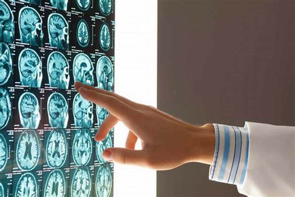پزشک در حال تفسیر ام آر آی بیمار است