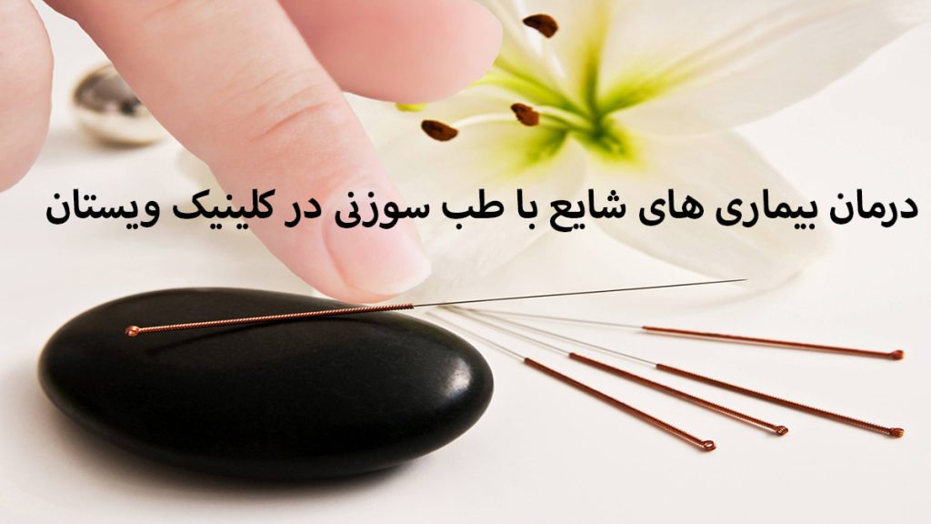 درمان بیماری های مختلف با طب سوزنی سوزن های طب سوزنی دست یک شخص و یک گل نشان داده می شود
