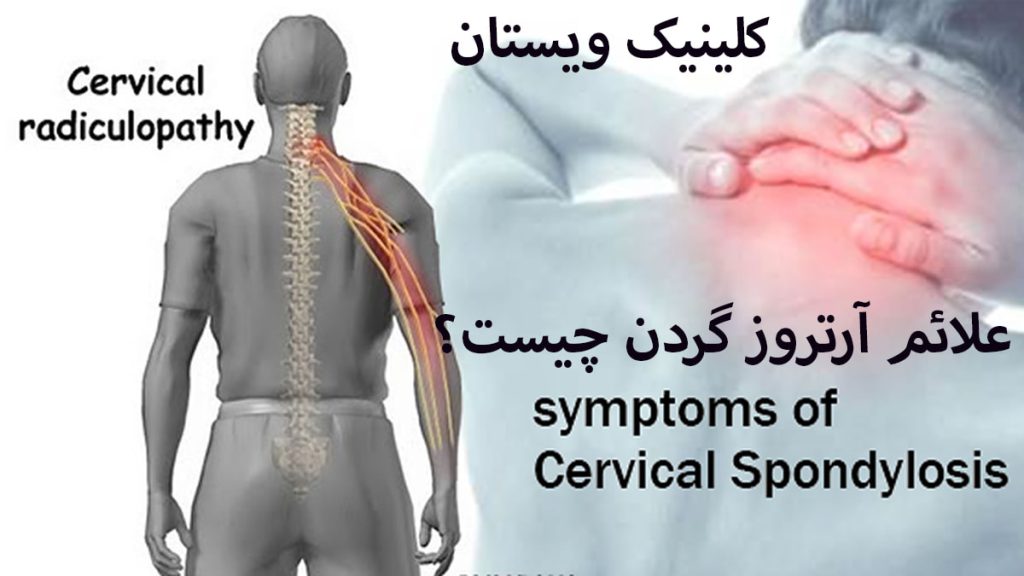 علائم آرتروز گردن اسکلت بدن فرد و درد در ناحیه گردن او