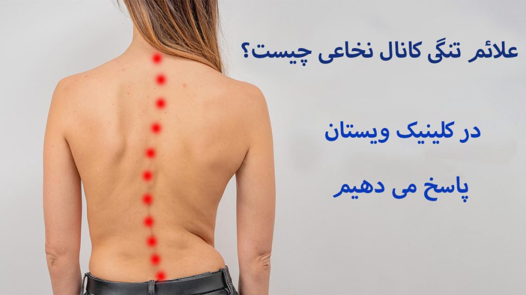 علائم تنگی کانال نخاعی یک خانم که ستون فقرات او با نقاط قرمز مشخص شده است