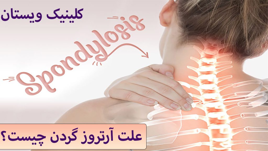 علت آرتروز گردن خانمی دارای درد در ناحیه مهره های گردن و نوشته ای با عنوان علت آرتروز گردن