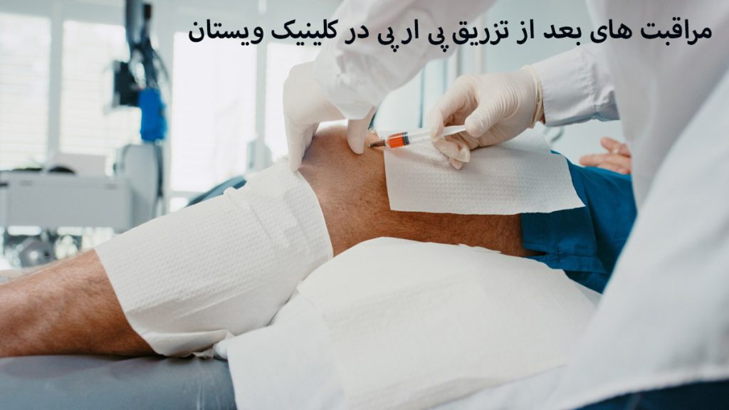 مراقبتهای بعد از تزریق PRP پزشک در حال تزریق پی ار پی به زانوی شخص بیمار