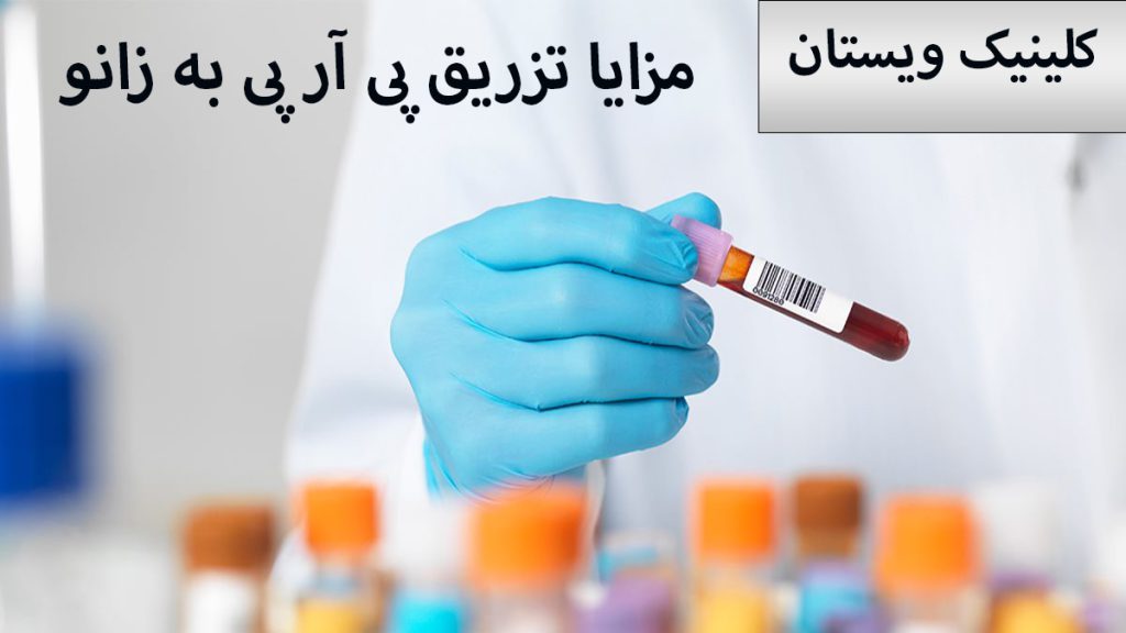 مزایای پی ار پی پی آر پی در دست یک پزشک نمایش داده می شود