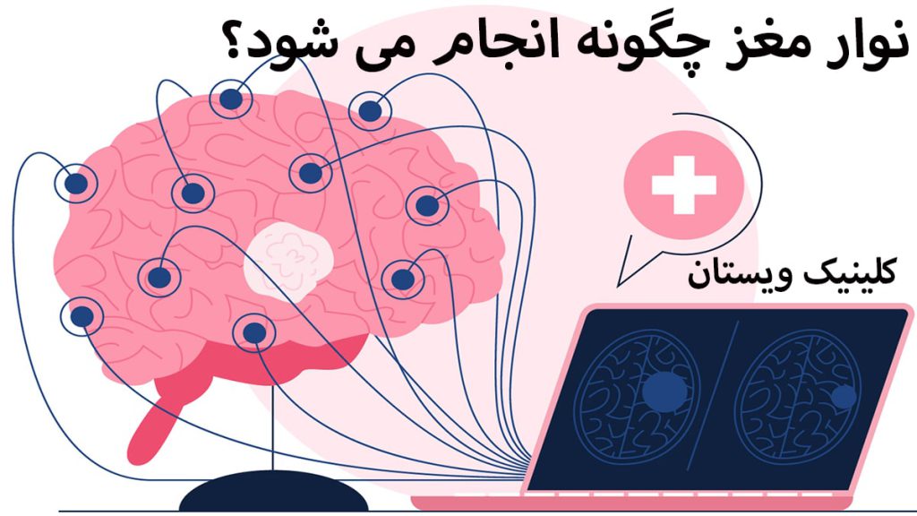 چگونگی انجام نوار مغز یک مغز که به آن الکترود های نوار مغز وصل شده است به همراه یک مانیتور