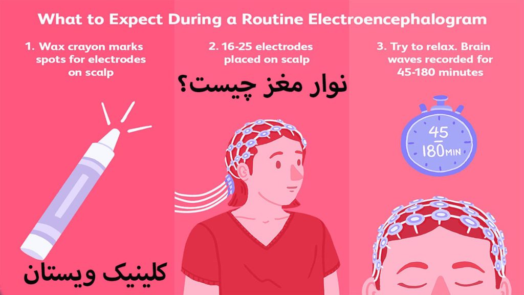 تست نوار مغز مراحل انجام نوار مغز نشن داده می شود