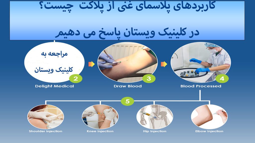 کاربرد پی ار پی مراحل پی آر پی و کاربربدهای آن نمایش داده می شود