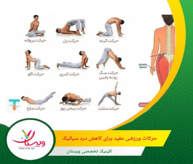 کشش کمر به جلو و کشش عضله پیریفورمیس میتوانند به کاهش درد سیاتیک و بهبود وضعیت کمک کنند حرکات ورزشی مفید برای کاهش درد سیاتیک