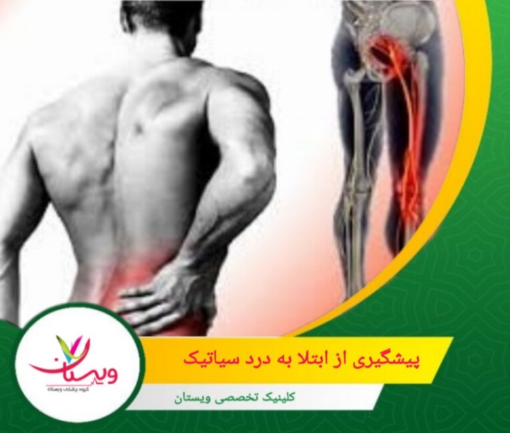 استفاده از تشک مناسب و قرار دادن بالش بین زانوها در هنگام خواب برای حفظ وضعیت طبیعی ستون فقرات. پیشگیری از ابتلا به درد سیاتیک