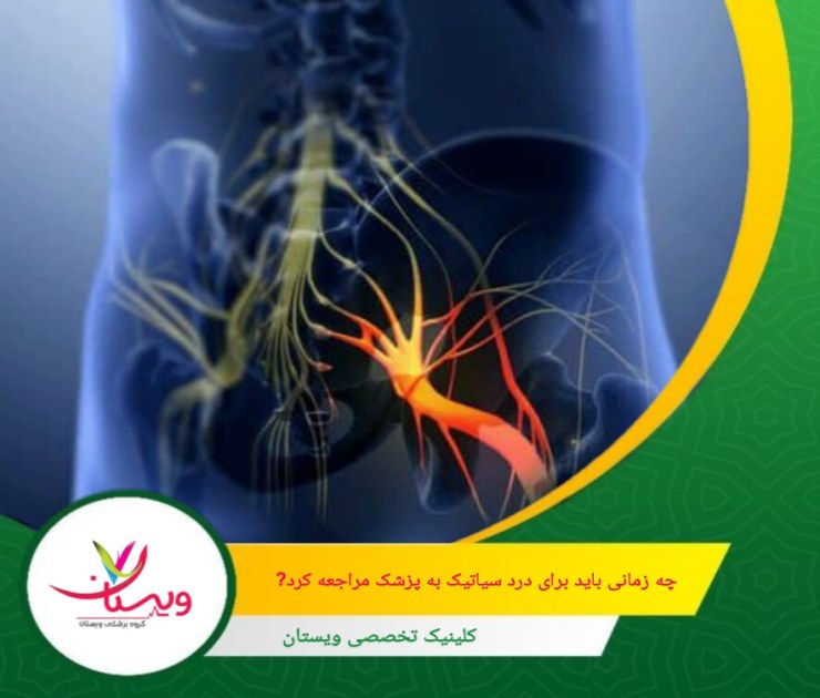 اگر پس از یک یا دو هفته استفاده از داروهای مسکن بدون نسخه، استراحت و تمرینات کششی، درد سیاتیک کاهش نیابد یا بدتر شود، باید با پزشک مشورت کنید. چه زمانی باید به پزشک مراجعه کرد؟