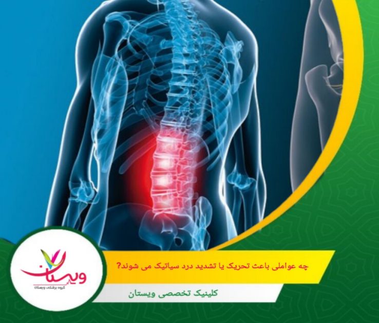 با رعایت سبک زندگی سالم و اجتناب از وضعیت بد بدن، میتوان شدت درد سیاتیک را کاهش داد اگر درد ادامهدار بود، حتماً با پزشک مشورت کنید. چه عواملی باعث تحریک یا تشدید درد سیاتیک میشوند؟