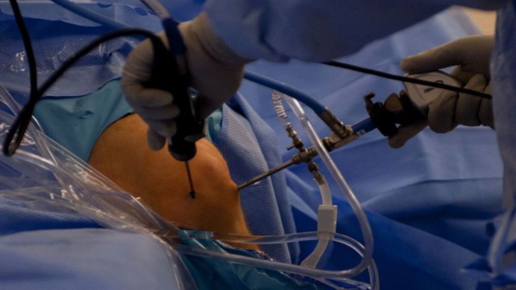 پزشک متخصص در حال جراحی مینیسک زانو پزشک متخصص در حال جراحی مینیسک زانو
