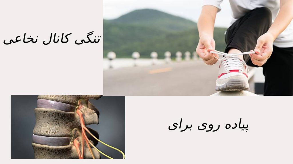 پیاده روی چه فوایدی دارد خانمی که بندکفشش رامی بندد تا به پیاده روی برود