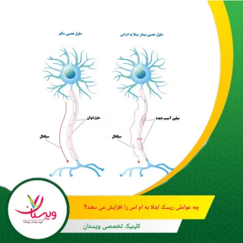 سفیدپوستان اروپای شمالی و ساکنان مناطق دور از خط استوا در معرض ریسک بالاتری هستند. چه عواملی ریسک ابتلا به اماس را افزایش میدهند؟
