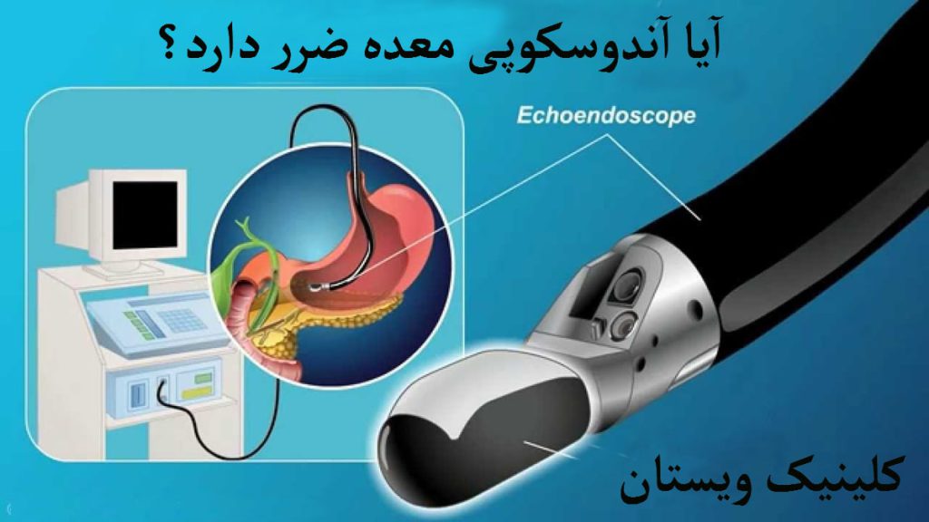 آیا آندوسکوپی ضرر دارد؟ یک دستگاه آندوسکوپی به همراه تصویری از معده