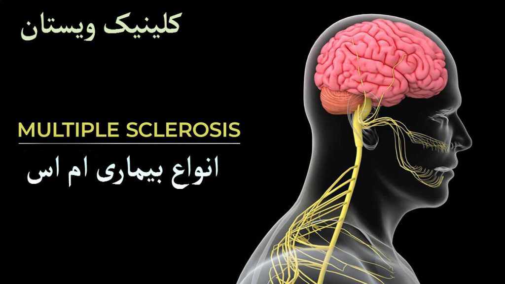 انواع بیماری ام اس تصویری دیجیتالی از مغز و گردن انسان