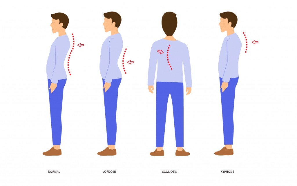 انواع ستون فقرات