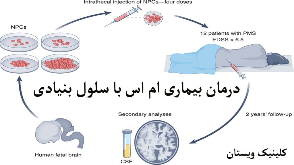 درمان ام اس با سلول بنیادی تصویری انیمیشنی از یک شخص که دراز کشیده و چرخه ای از درمان بیماری ام اس نشان داده می شود