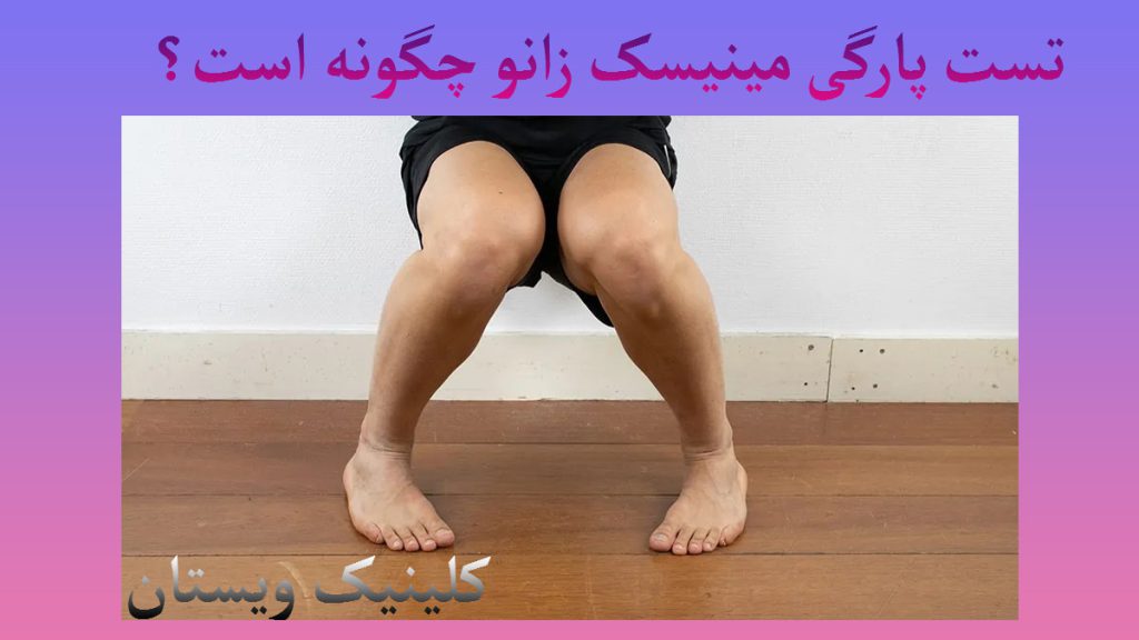 تست پارگی مینیسک زانو شخصی تست برای پارگی مینیسک زانو را انجام می دهد