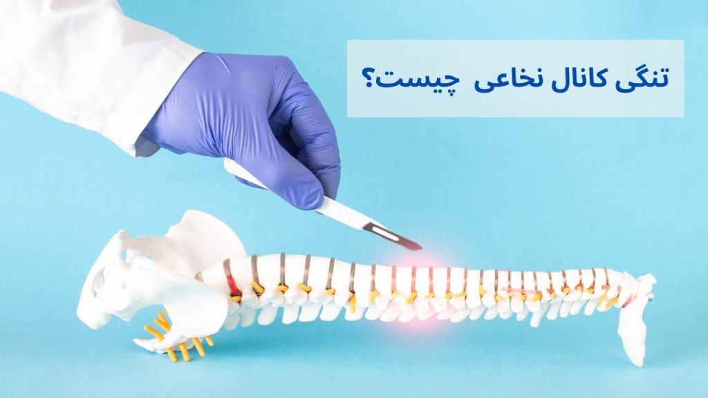 درمان تنگی کانال نخاعی با متخصصان برتر کلینیک ویستان بهترین دکتر برای تنگی کانال نخاعی در تهران کلینیک ویستان