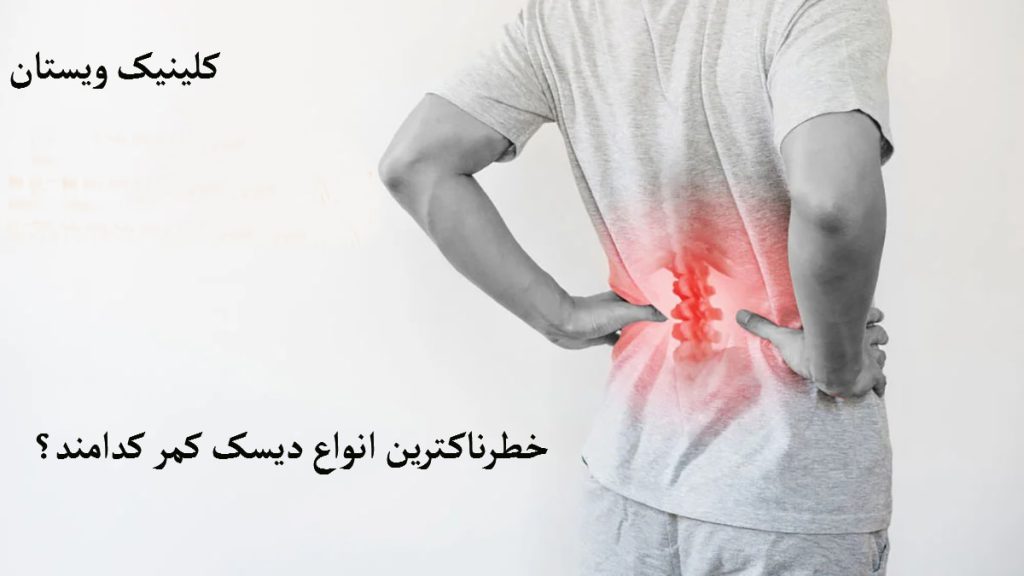 خطرناکترین دیسک کمر یک شخص که در قسمت کمر دچار درد شده است