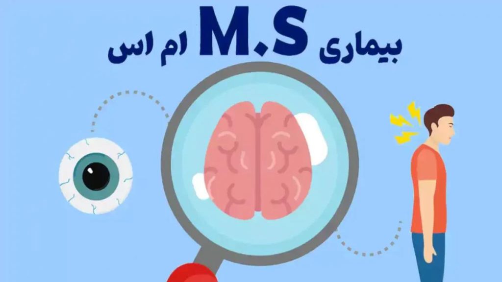 طول عمر بیشتر بیماران اماس درمانهای اماس
