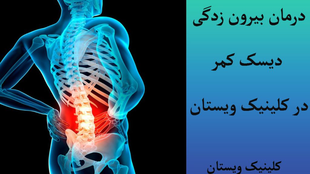 یک عکس دیجیتالی از انسان با نشان دادن درد در قسمت کمر و ستون فقرات