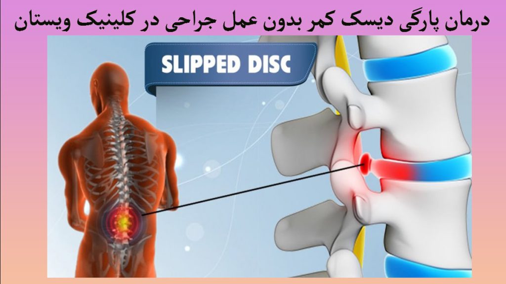 در سمت راست ستون فقرات انسان که آسیب دیده در سمت چپ تصویری دیجیتالی از بدن انسان و ستون فقرات او
