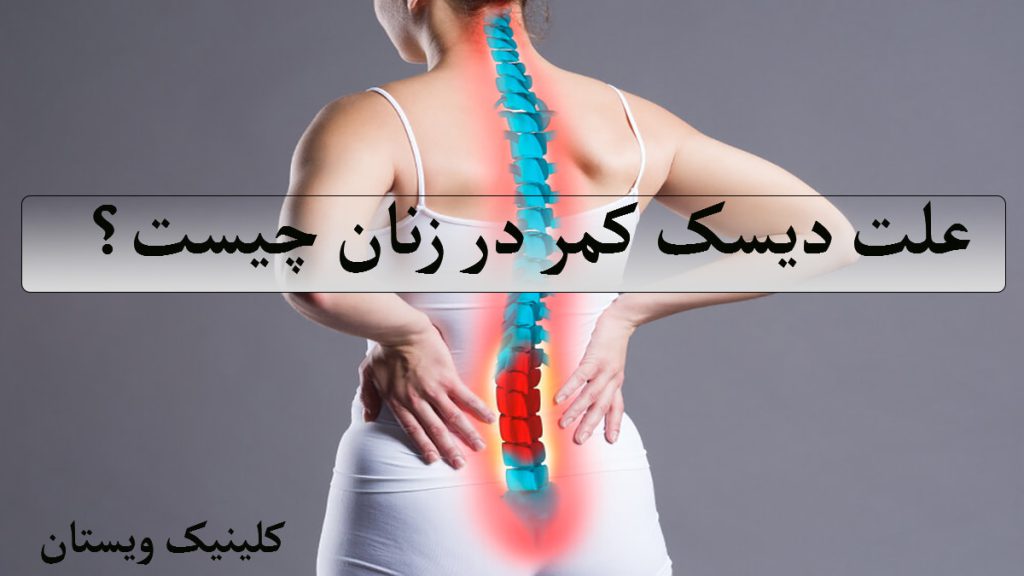 علت کمر درد زنان یک خانم که ستون فقرات او با رنگ آبی و قرمز مشخص شده است