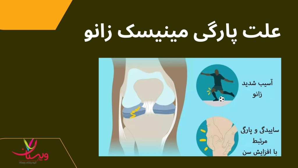 آسیبپذیری مینیسکها مفصل زانو