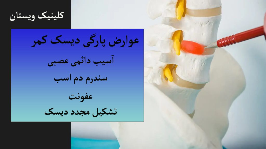عوارض پارگی دیسک کمر شخصی با یک مداد به قسمت آسیب دیده ستون فقرات اشاره می کند