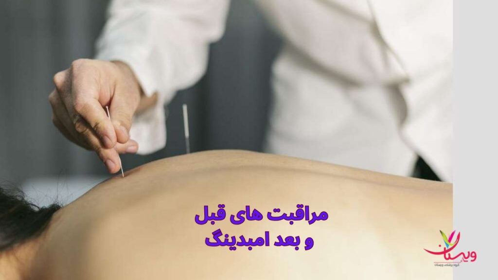 مراقبت های قبل و بعد از امبدینگ کردن مراقبت های قبل و بعد امبدینگ