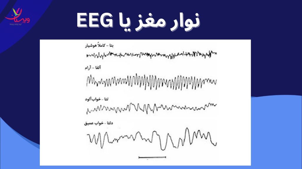 ثبت فعالیت الکتریکی مغز الکتروانسفالوگرافی