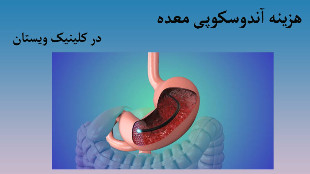 هزینه آندوسکوپی تصویری دیجیتالی از معده به همراه نوشته ای درباره هزینه آندوسکوچی