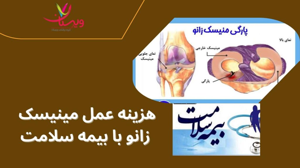 جلسات فیزیوتراپی درمان مینیسک زانو